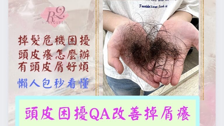 【頭皮困擾QA油屑敏掉髮】掉髮危機困擾? 有頭皮屑怎麼辦? 頭皮好癢!? 毛囊各種疑問?  ﻿  | ﻿ 露比髮屋